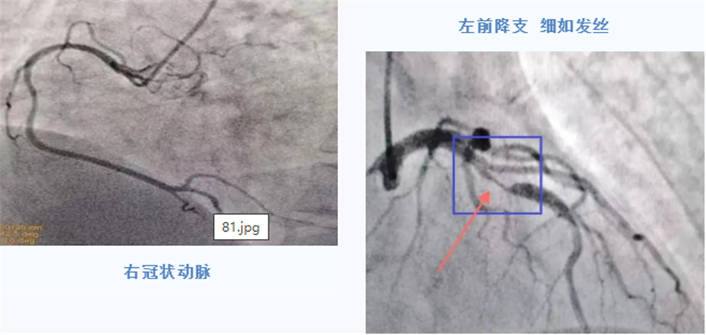 微信图片_20230106091238.png